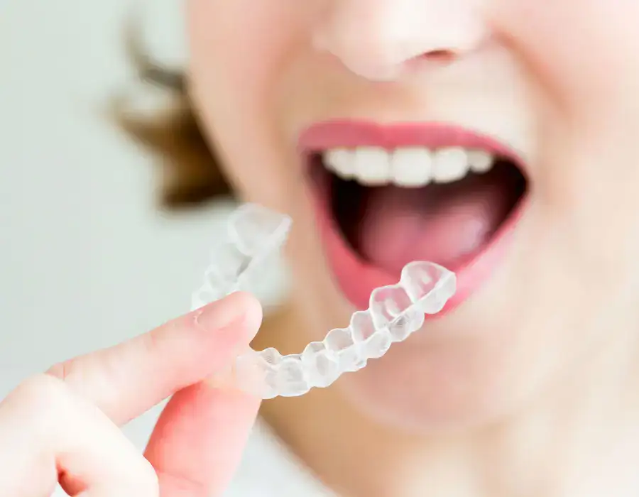 invisible braces in indore, braces in indore, dentist in indore