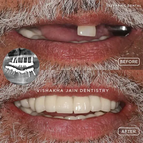 dentist in indore, best dental clinic indore, indore best dental clinic