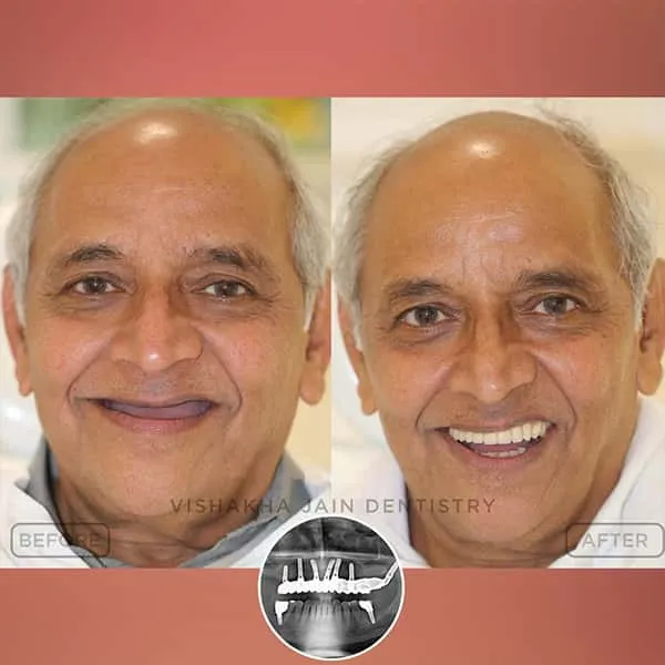 best dental clinic indore, indore best dental clinic