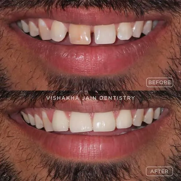 dental clinic indore, best dental clinic indore